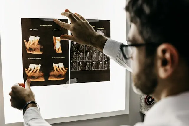 Implantes dentales — titanio de alta resistencia